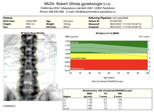 DXA_spine